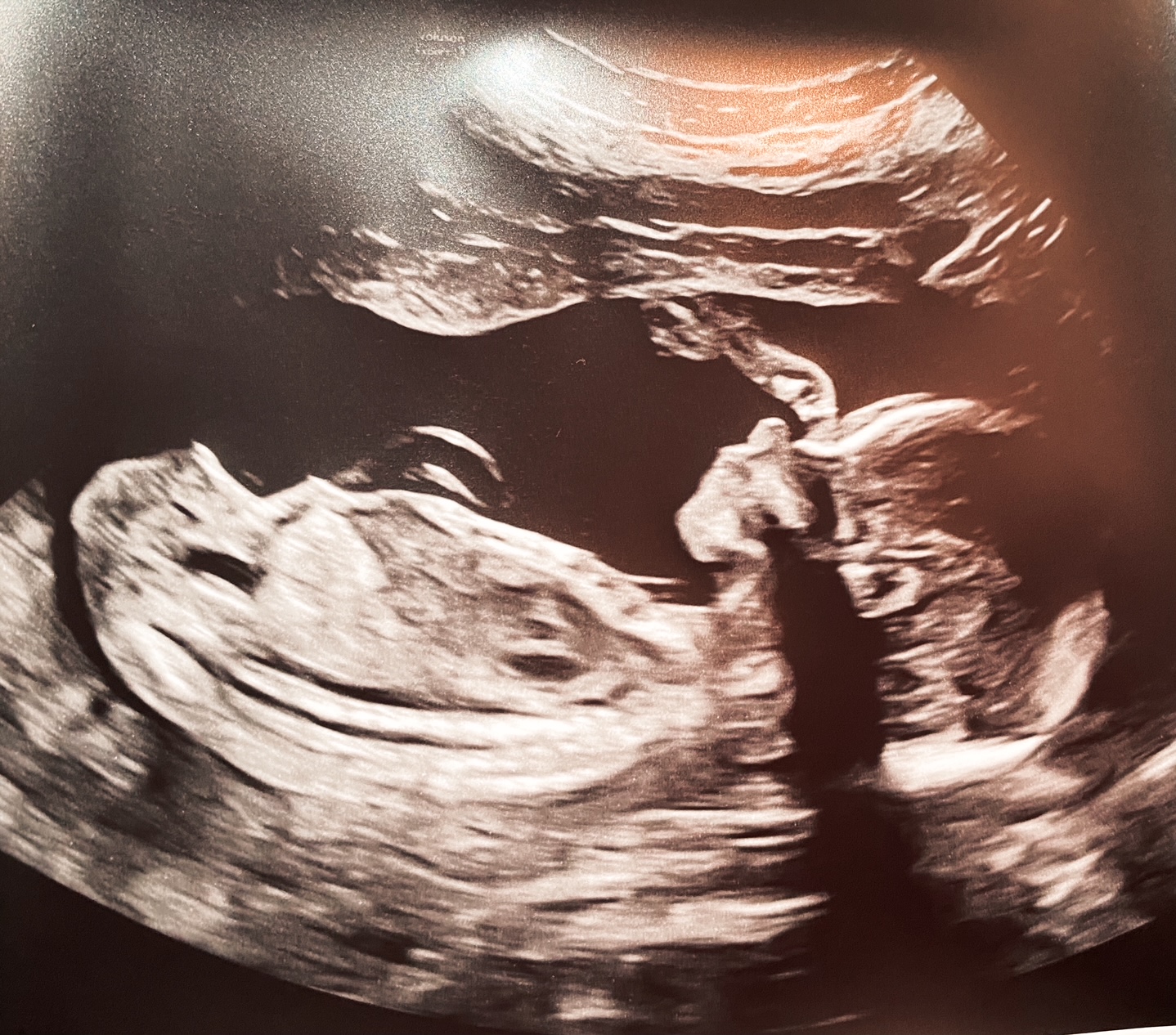 infant nyla anastasia trammell